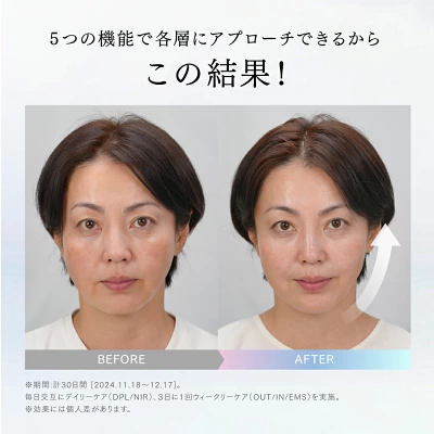 マイトレックスミライワンの特長